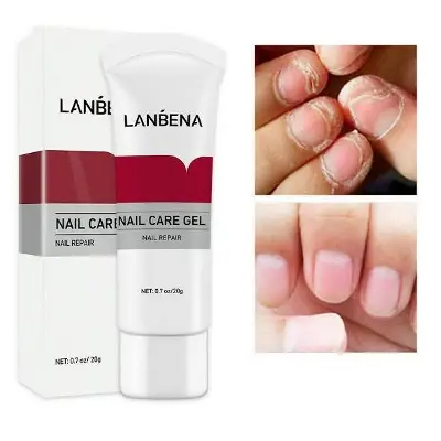 Picture of LANBENA Nail Fungus Removal cream Treatment Onychomycosis Paronychia Anti Infection Feet Toe Nail Care Gel Fungal Nail Product-20GM