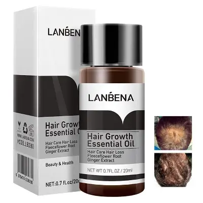 Picture of LANBENA Hair Growth Essencial Oil  Hair Growth Oils for Hair Thickening Hair Loss Treatment Thinning Hair Treatment Growing Hair -20ml