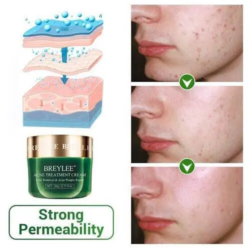Picture of BRYELEE Acne Treatment Cream Face Cream Pimple Removal Spots Oil Control Anti Acne Shrink Pores Moisturizing Serum Skin Care 20g