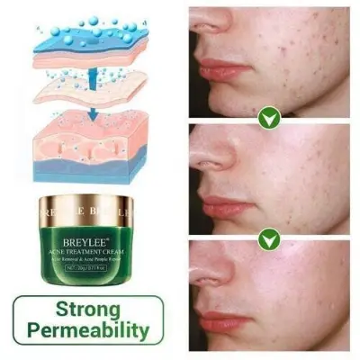 Picture of BRYELEE Acne Treatment Cream Face Cream Pimple Removal Spots Oil Control Anti Acne Shrink Pores Moisturizing Serum Skin Care 20g