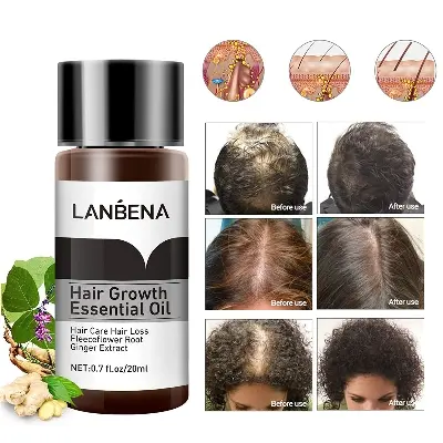 Picture of LANBENA Hair Growth Essence Spray Product Preventing Baldness Consolidating Anti Hair Loss Nourish Roots Easy To Carry Hair Care