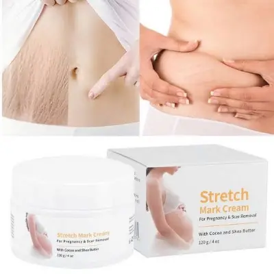 Picture of MELAO Women Remove Pregnancy Scars Acne Cream Stretch Marks Treatment Maternity Repair Anti-Aging  Body Creams-120gm