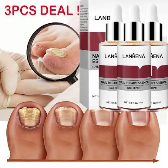 Picture of LANBENA Nail Repair Essence Serum Fungal Nail Treatment [3PCS+Teeth Whitening Essence Free]
