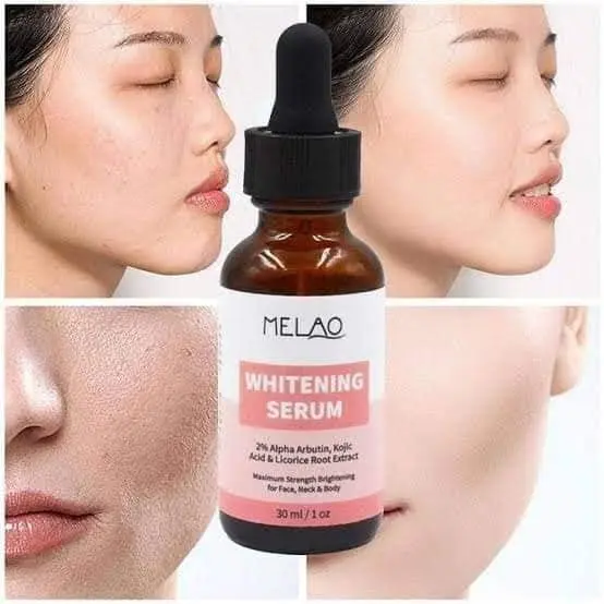 Picture of Melao Natural Whitening Serum for Face Vitamin E Skin Care Essence- 30ml