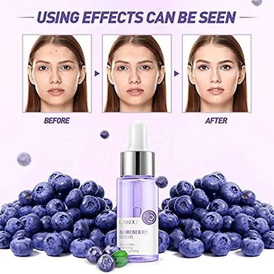 Picture of LAIKOU Blueberry Anti Wrinkles Facial Serum Brighten Skin Tone Hydrating Repair Damaged Skin Whitening Remove Spots Skin Care-17ml