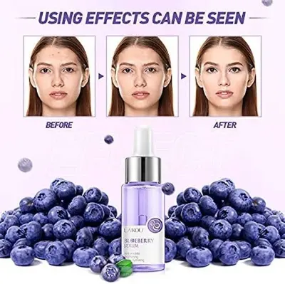 Picture of LAIKOU Blueberry Anti Wrinkles Facial Serum Brighten Skin Tone Hydrating Repair Damaged Skin Whitening Remove Spots Skin Care-17ml