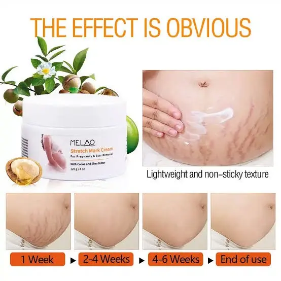 Picture of Melao Stretch Mark Cream For Pregnancy And Scar Removal Treatment With Cocoa And Shea Butter Belly Moisturizer-120gm
