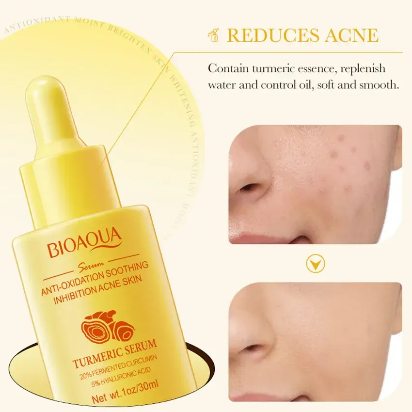 Picture of BIOAQUA Turmeric Essence Brightening Acne Relieving Serum – 30ml