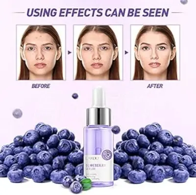 Picture of LAIKOU Blueberry Anti Wrinkles Facial Serum Brighten Skin Tone Hydrating Repair Damaged Skin Whitening Remove Spots Skin Care-17ml