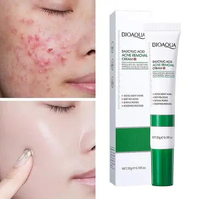 Picture of BIOAQUA Acne Removal Cream Anti Acne Treatment Repair Marks Moisturizing Blackhead Remover Facial Cream Skin Care-20gm