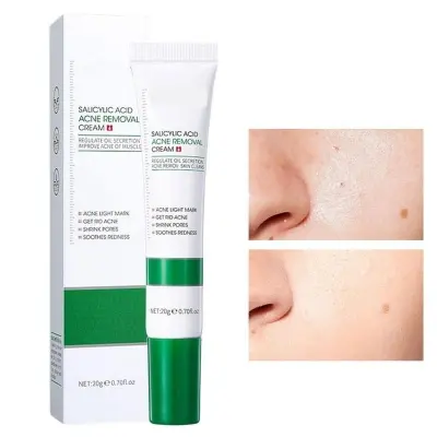 Picture of BIOAQUA Acne Removal Cream Anti Acne Treatment Repair Marks Moisturizing Blackhead Remover Facial Cream Skin Care-20gm