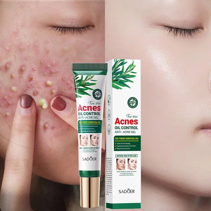 Picture of SADOER Tea Tree Acne Oil Control Face Gel Anti-Acne Gel 20g