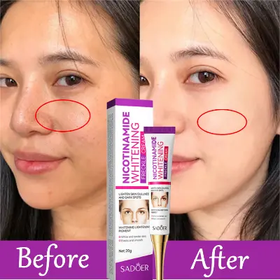 Picture of SADOER Whitening and Freckle Removal Cream Moisturizing Moisturizing and Fading Niacinamide Cream-20gm