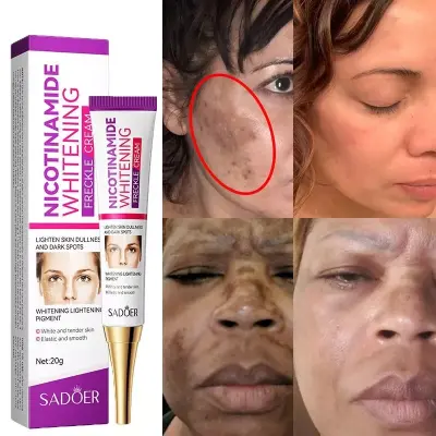 Picture of SADOER Whitening and Freckle Removal Cream Moisturizing Moisturizing and Fading Niacinamide Cream-20gm