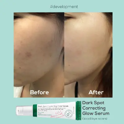 Picture of AXIS-Y Dark Spot Correcting Glow Serum MINI 5ml