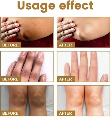 Picture of JAYSUING Private Label Therapy Drops Serum Knee Elbow Finger Joint Brightening Darkening Treatment Skin Care Serum-10ml