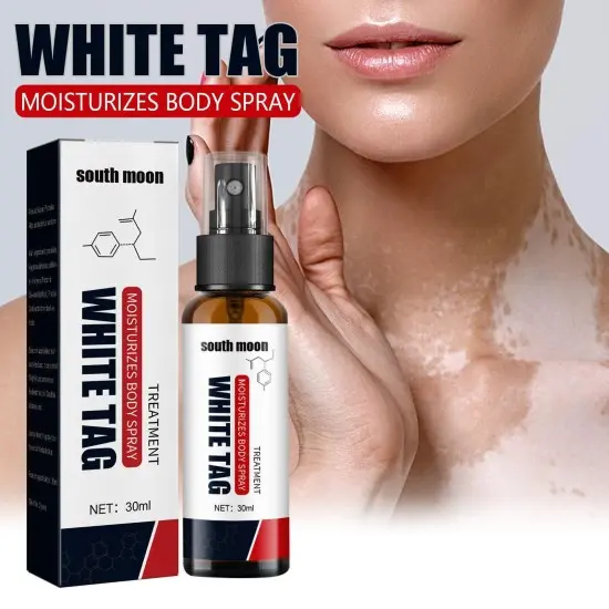 Picture of South Moon Vitiligo Treatment Spray Moisturizing Reduces White Spots Leukoplakia Disease Pigment Melanin Repair White Tag Care-30ml