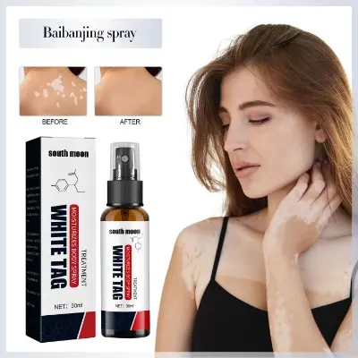Picture of South Moon Vitiligo Treatment Spray Moisturizing Reduces White Spots Leukoplakia Disease Pigment Melanin Repair White Tag Care-30ml