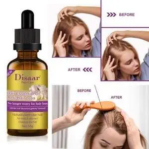 Picture of Disaar 30ml Fast Hair Growth Essential Oil Ginger Formula Anti-hair Loss Oil Head Scalp Treatment For Men And Women