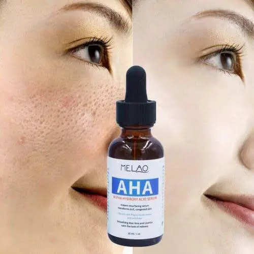 Picture of MELAO Natural Oil Control Pore Shrinking Serum Alpha Hydroxy Acid AHA Serum AHA Whitening Serum-30ml