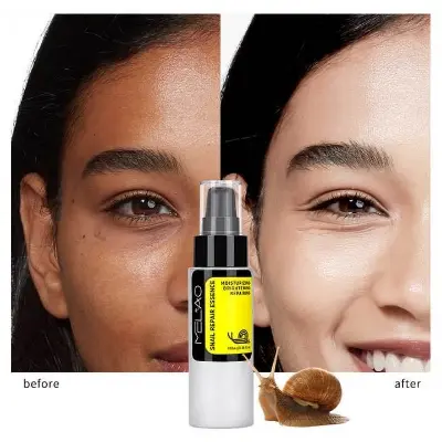 Picture of •MELAO Snail Serum Hyaluronic Acid Essence Face Cream Moisturizing Acne Treatment Skin Care Repair Whitening Anti-Aging-100ml