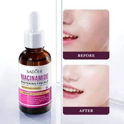Picture of SADOER Niacinamide Skin Whitening Face Serum for Shrink Pores, Dark Spots and Freckles serum-30ml