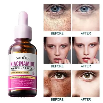 Picture of SADOER Niacinamide Skin Whitening Face Serum for Shrink Pores, Dark Spots and Freckles serum-30ml