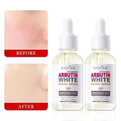 Picture of Sadoer Nicotinamide Arbutin White Facial Serum-30ml