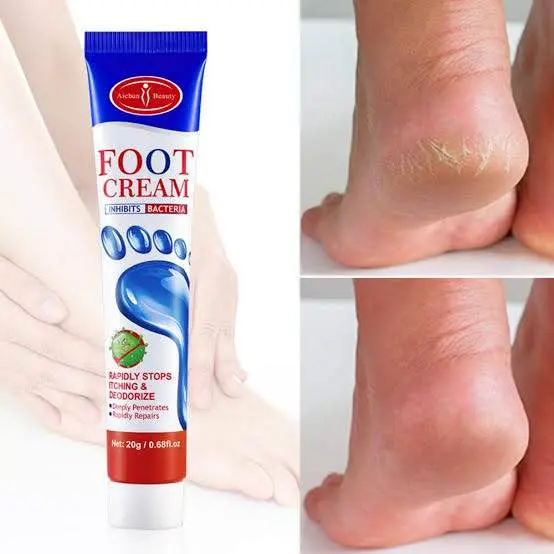 Picture of Aichun Beauty Foot Cream Balm For Cracked Heel Dead Skin Remover Foot Cream Anti-Crack Deep Moisturizing Foot Cream-20gm