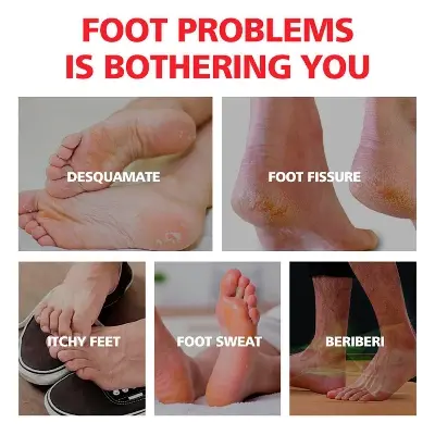 Picture of Aichun Beauty Foot Cream Balm For Cracked Heel Dead Skin Remover Foot Cream Anti-Crack Deep Moisturizing Foot Cream-20gm