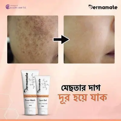 Picture of Dermamate Melasma Solution Spot Face wash + Gel -2 pcs combo