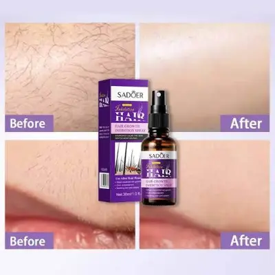 Picture of Sadoer Lavender Essence Anti Hair Grow Serum Spray 30ml (Reduce Hair Slow Hair Growth)