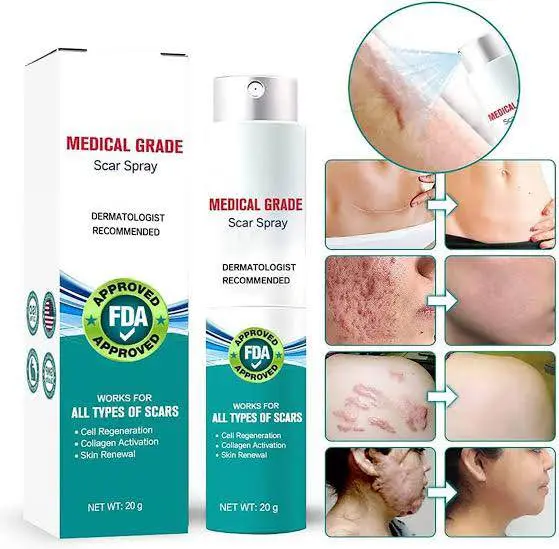 Picture of South Moon Medical Grade Scar Spray, Scar Remove Medical Grade Scar Spray-20gm