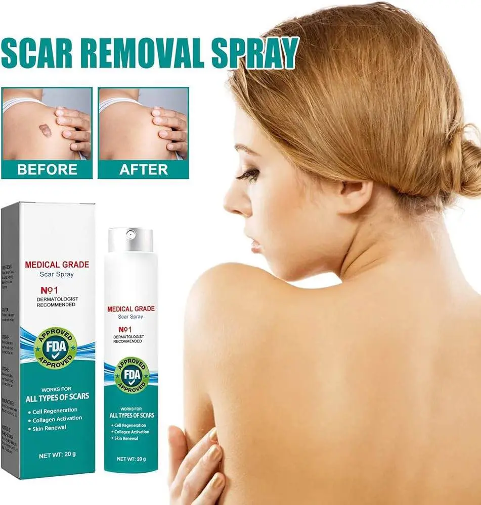Picture of South Moon Medical Grade Scar Spray, Scar Remove Medical Grade Scar Spray-20gm