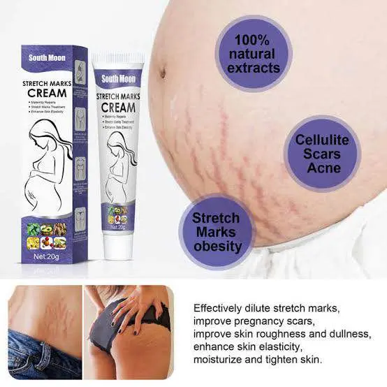 Picture of South Moon Effective Body Stretch Marks Removal Cream Lotion Pregnancy Stretch Mark Cream for Fair Skin Repair Cream 20g