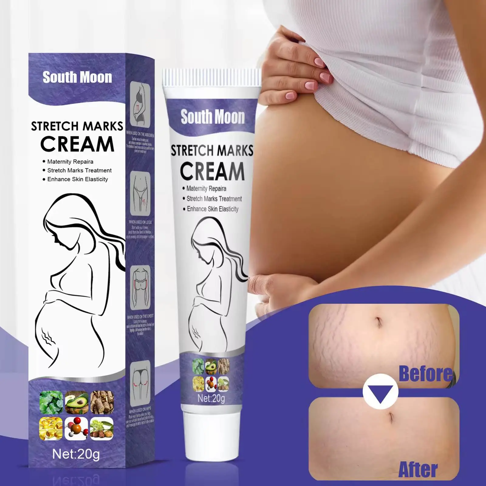 Picture of South Moon Effective Body Stretch Marks Removal Cream Lotion Pregnancy Stretch Mark Cream for Fair Skin Repair Cream 20g