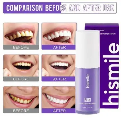 Picture of Hismile v34 Whitening Toothpaste Colour Corrector Teeth Stain Removal-30ml