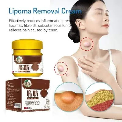 Picture of Huangfutang Lipoma Removal Cream-20gm