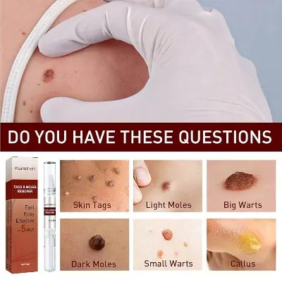 Picture of Moles Remover Pen West Month Tags 3 Ml