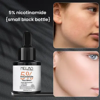 Picture of MELAO 5% Niacinamide Serum, Skin Treatment, Pore Minimizer, With Hyaluronic Acid, Vitamin E Hydrating Face Serum