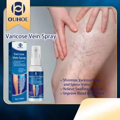 Picture of Varicose Veins Spray Medicine Spider Veins Relief Vasculitis Phlebitis Spider Pain Relief Plaster Care 30ml