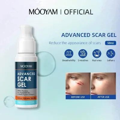 Picture of MOOYAM Advanced Scar Gel - 50ml