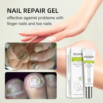 Picture of EELHOE Nail Fungus Treatment Repair Gel-20gm