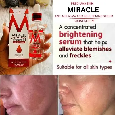 Picture of Miracle Anti-Melasma and Brightening Facial Serum-50ml