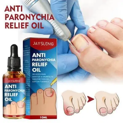 Picture of Jaysuing  Anti Paronychia Relief Oil – Nail Fungus Removal Feet Toe Fungal Care Ointment-10ml