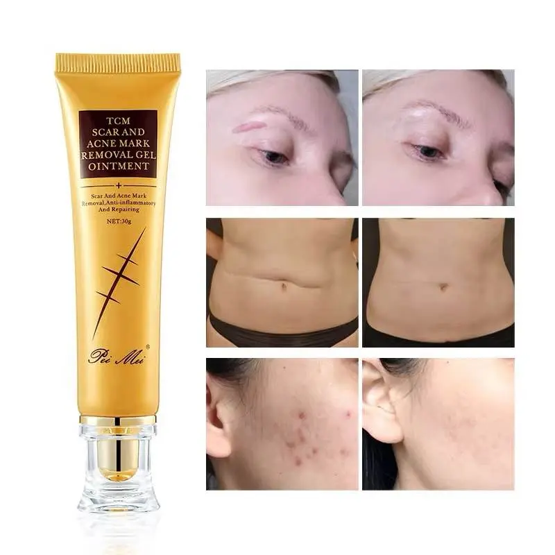 Picture of Pei Mei Tcm Scar And Acne Mark Removal Gel Ointment -30gm