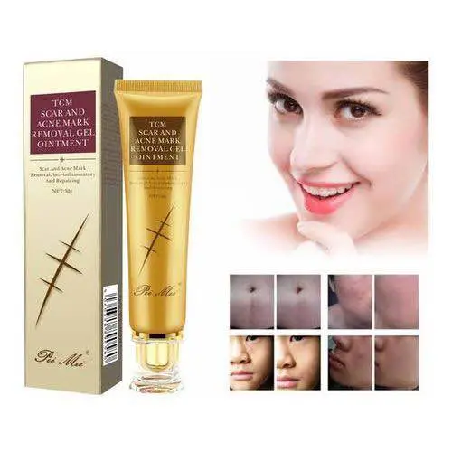 Picture of Pei Mei Tcm Scar And Acne Mark Removal Gel Ointment -30gm
