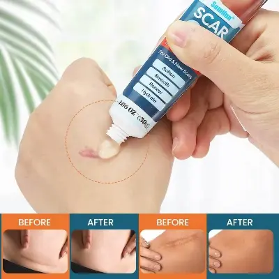 Picture of Sumifun Scar Removal Cream Natural Herbal Scar Lightening Repairing Gel Skin Care Cream 30g