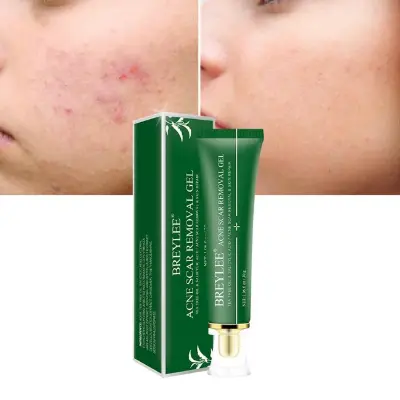 Picture of BREYLEE Acne Scar Removal Gel 30gm Green