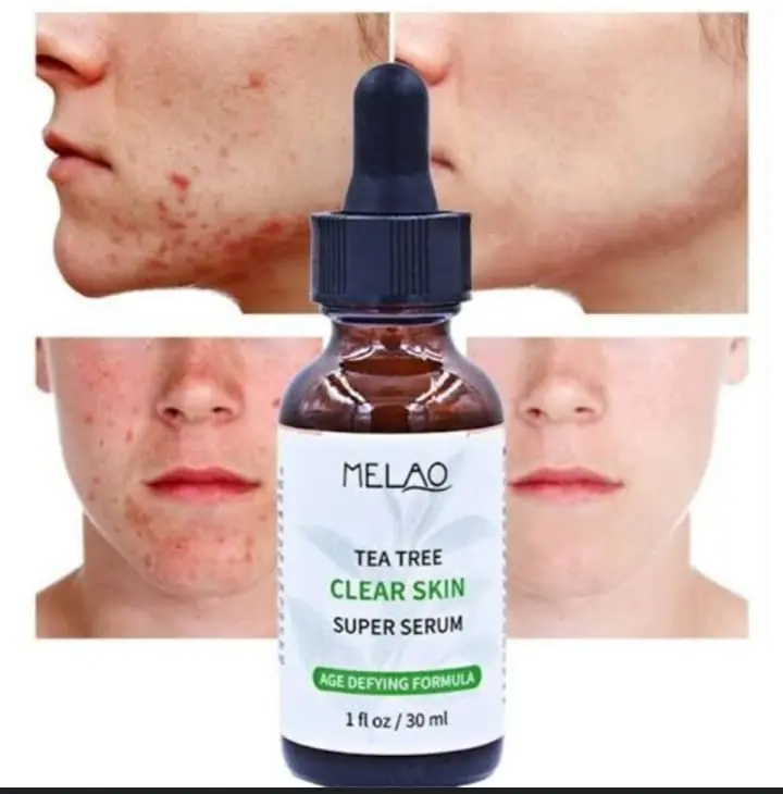Picture of Melao Tea Tree Clear Skin Serum – 30 ml Green